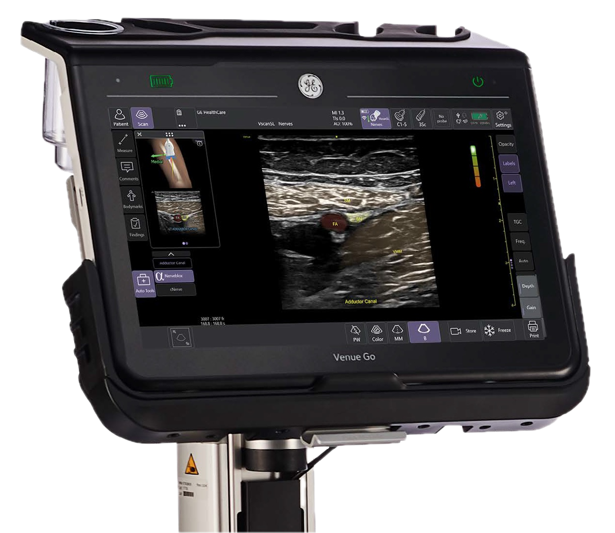 Nerveblox running on a GE HealthCare ultrasound system
