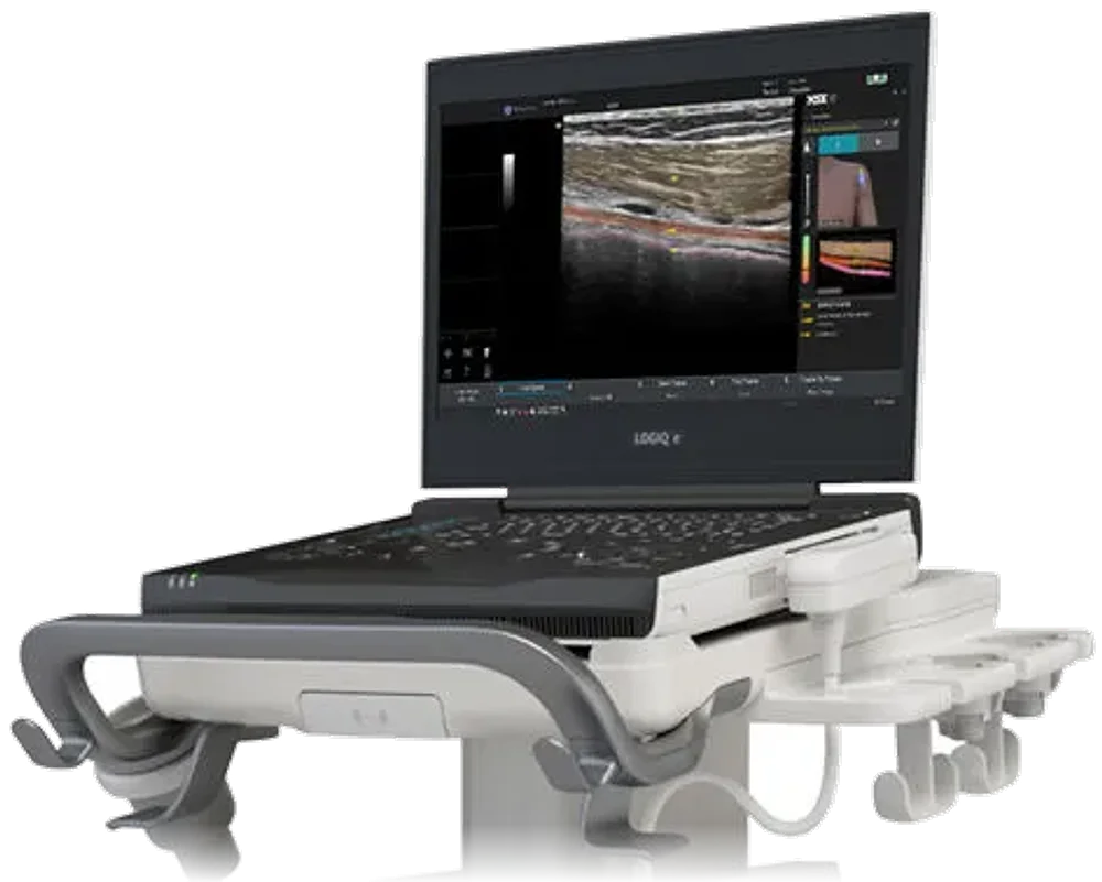 MSK Go running on a portable ultrasound system