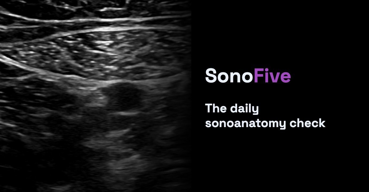 SonoFive is Live: Your Daily Sonoanatomy Check